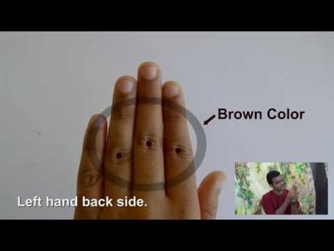 Ancient Remedies: Treatment for Joint Pain - Color Therapy