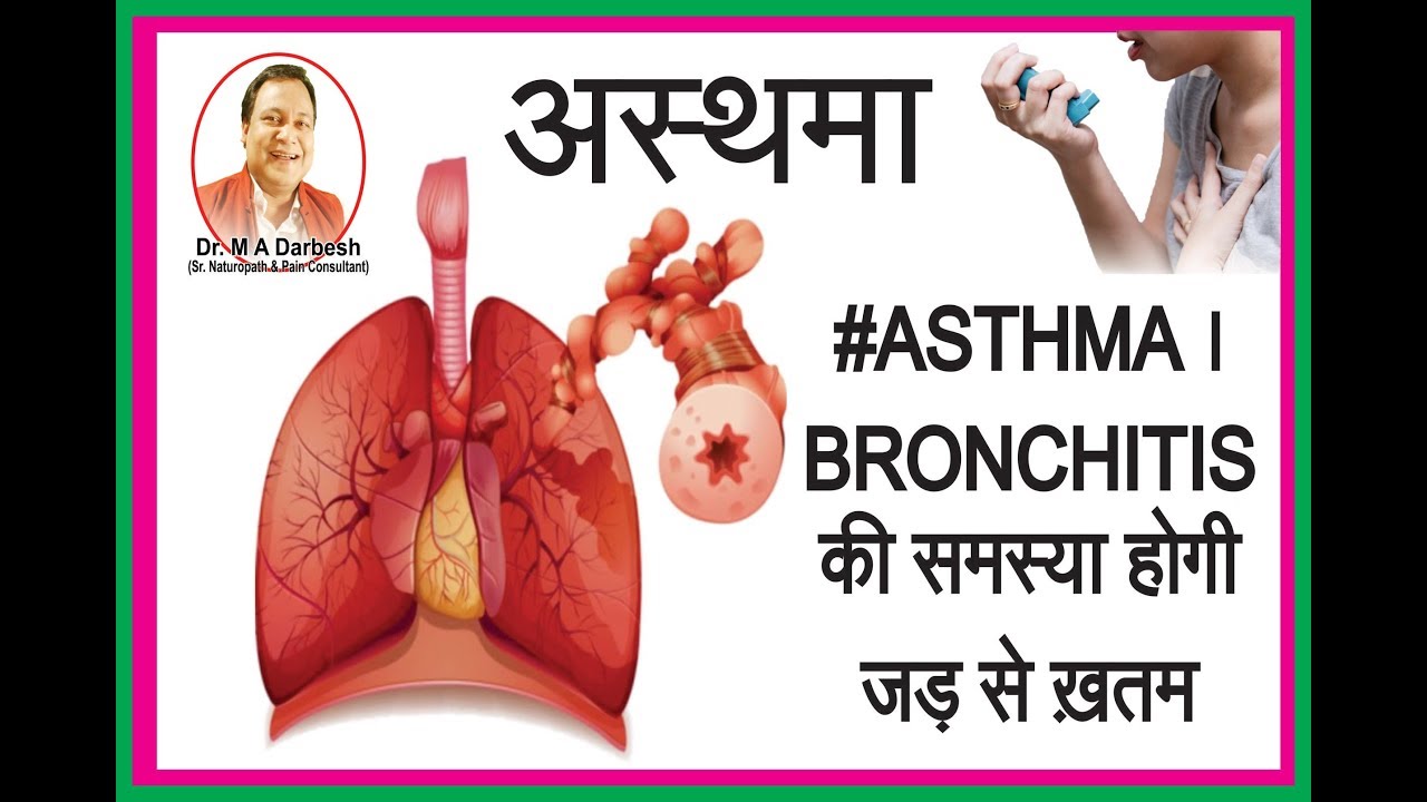 #ASTHMA । #BRONCHITIS की समस्या होगी जड़ से ख़तम । ACUPRESSURE & COLOR THERAPY |  By Dr. Darbesh