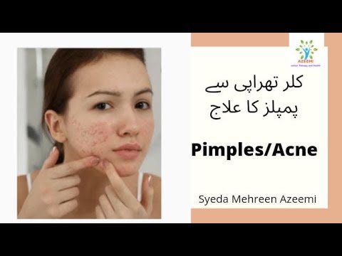 Color therapy sy pimple/Acne /پمپلز کا علاج/Causes /Symptoms & treatment to cure Acne