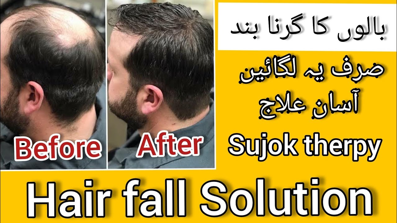 Hair fall and dandruff treatment with sujok color therapy | easy solution of hari fall
