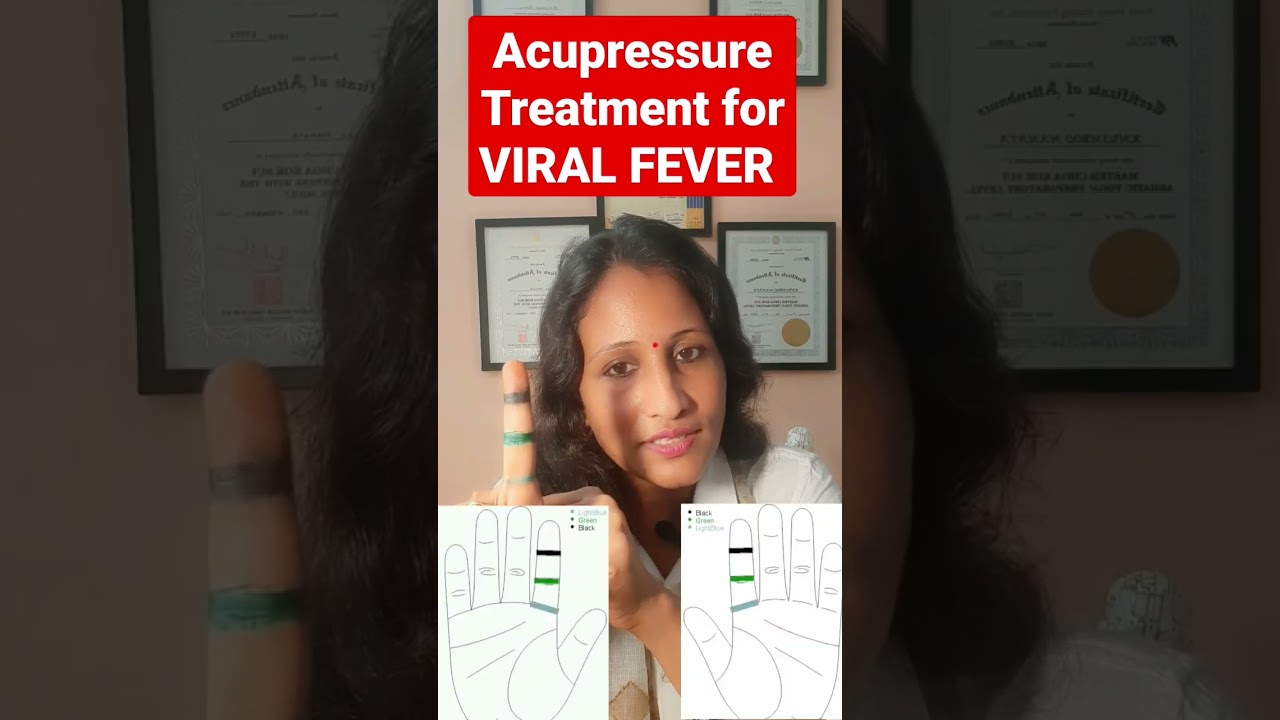 Acupressure Colour Therapy Treatment for VIRAL FEVER #shorts #viralfever